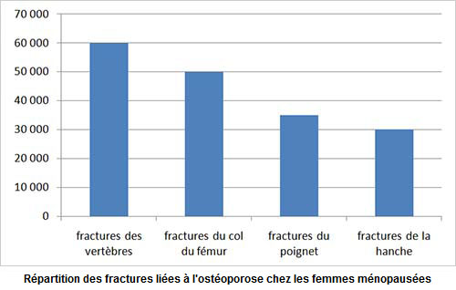 Répartition des fractures liées à l’ostéoporose