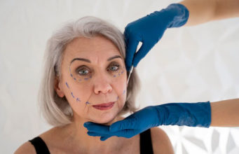 chirurgie esthétique