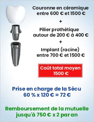 prix implant dentaire 2026
