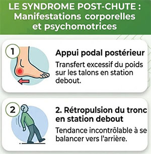 syndrome post-chute